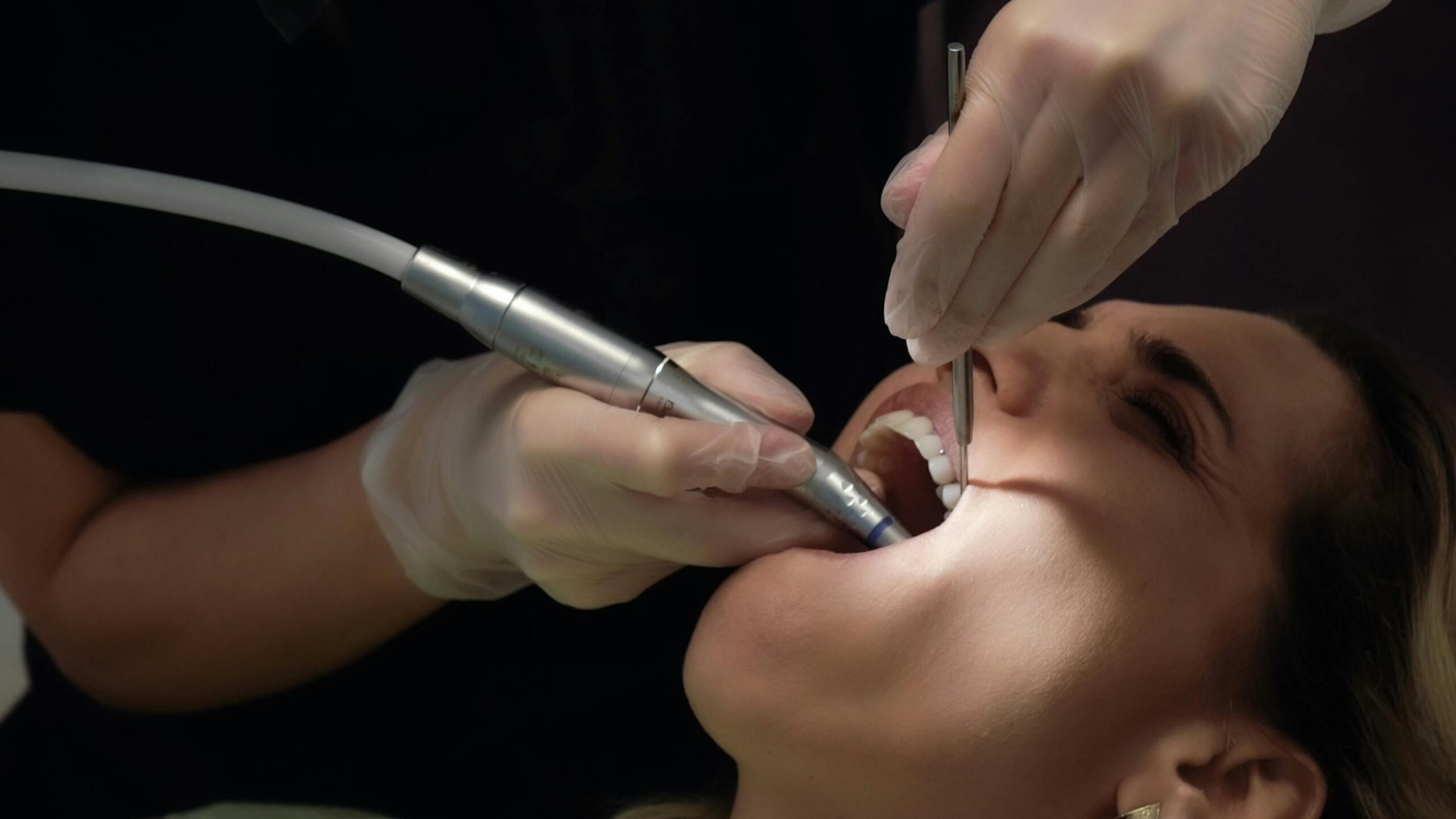 Close-up dental procedure with patient, focusing on dental tools and hands in action.