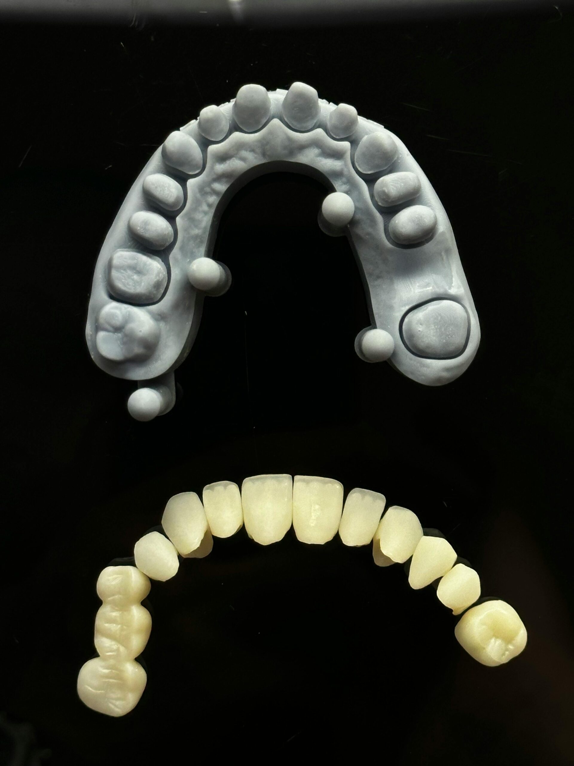 Detailed view of a dental cast and prosthetic teeth arrangement, ideal for dental references.