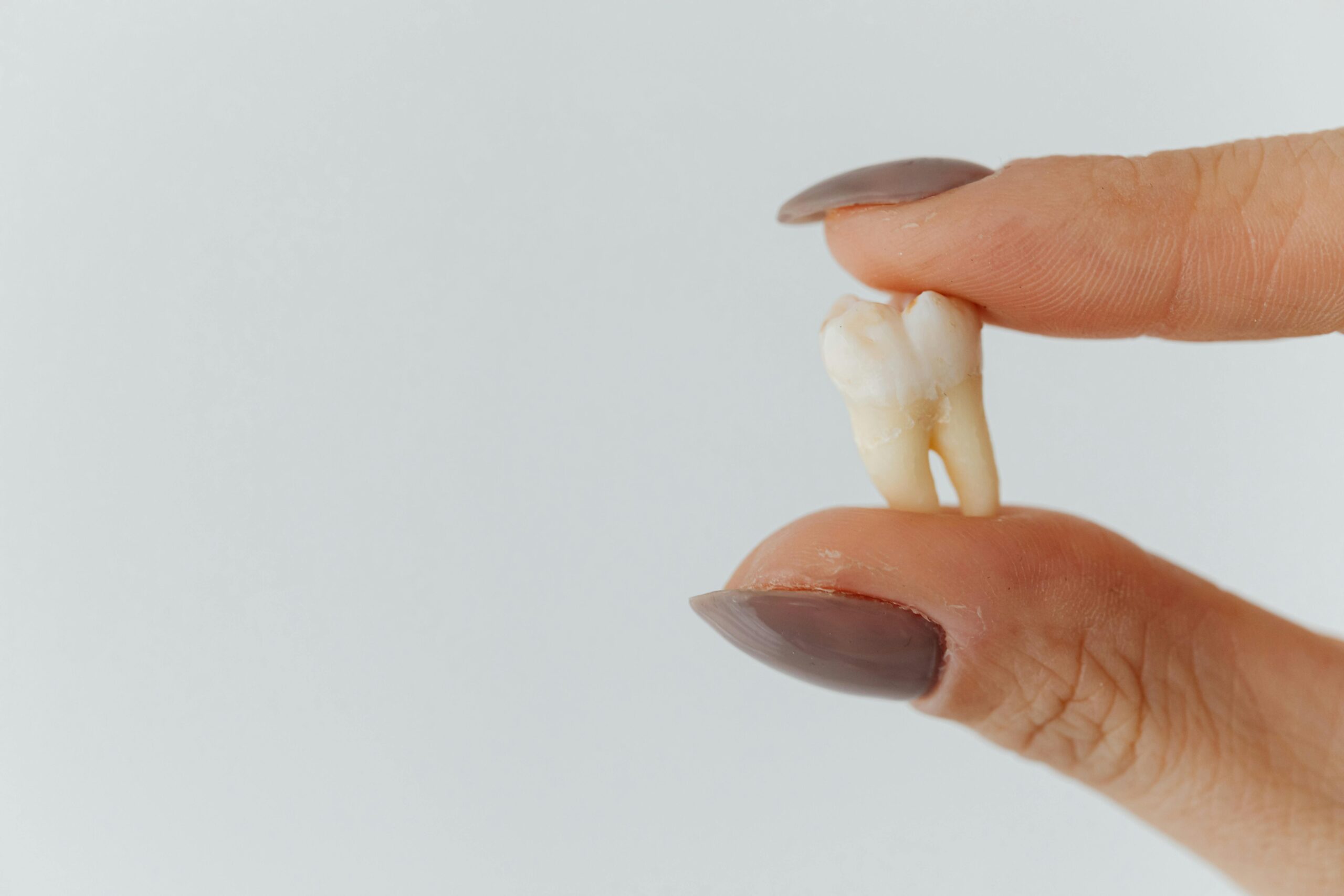 Detailed close-up of fingers holding a loose tooth against a white background.